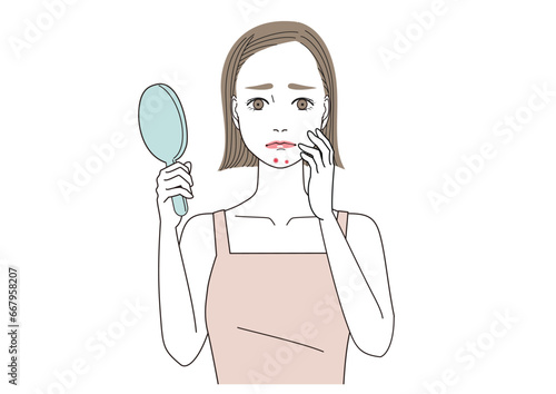 あごにニキビができて悩んでいる女性
