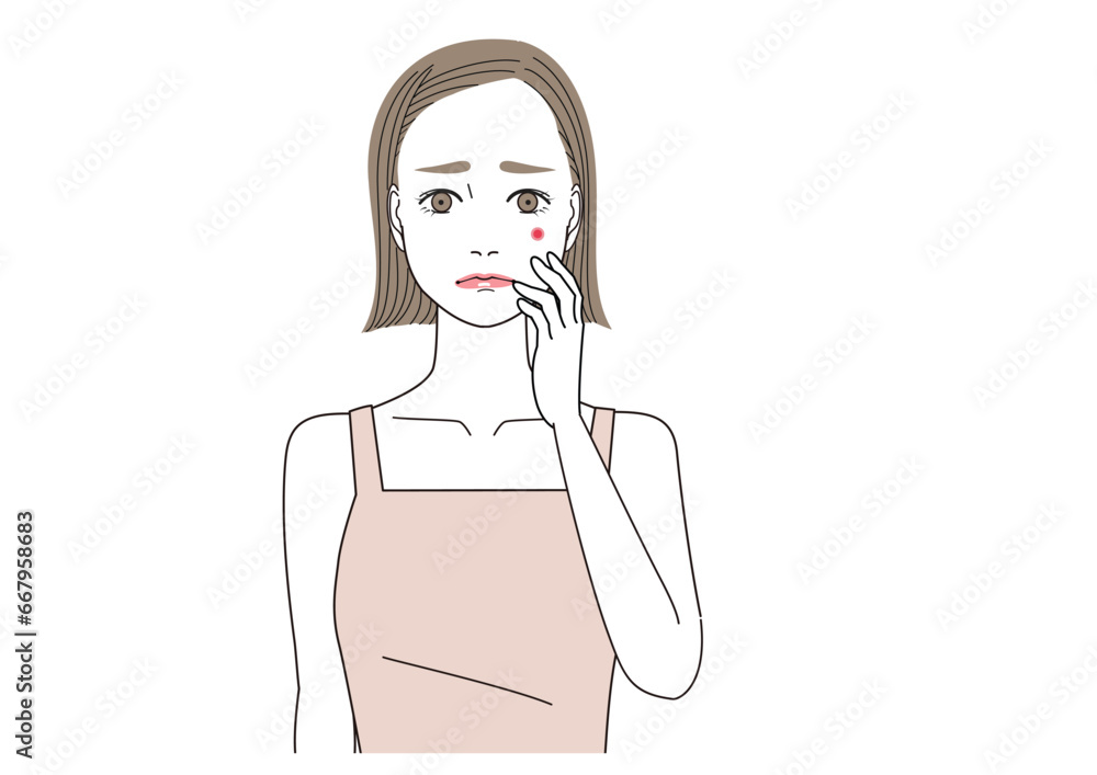 頬に大きなニキビができている女性