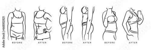 collection of illustration of a woman's body shape after and before doing fitness or exercising regularly. abstract line with various poses style. black and white colors.