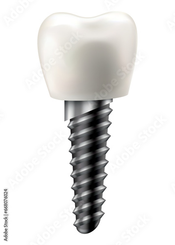 Fototapeta Naklejka Na Ścianę i Meble -  Dental implant structure. Medical educative infographic poster. Teeth implant, realistic vector design of dentistry. Implant screw, healthcare, dentist and orthodontist treatment