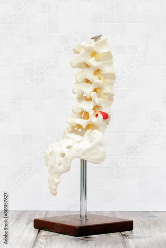 A model of a thoracic spine shot on a wooden table and white tiled background, showing back and side view of spine and a herniated disc
