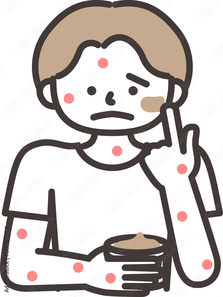 塗り薬を塗る男の子 塗り薬を塗る男の子