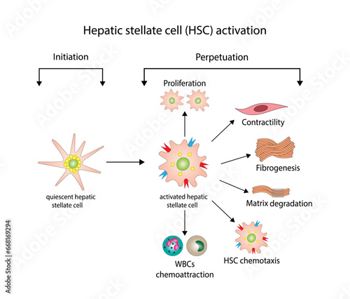 hepatic stellate cell (HSC) activation involving initiation and perpetuation processes. Hepatic fibrosis, liver fibrosis pathogenesis. Vector illustration.