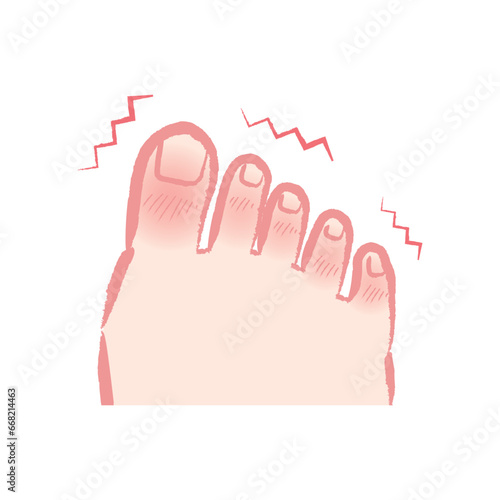 しもやけ・凍瘡で痒そうな足指のイラスト