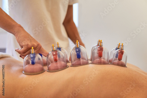 Therapist checking patient spine during cupping treatment. Healthcare suction massage on the spa photo