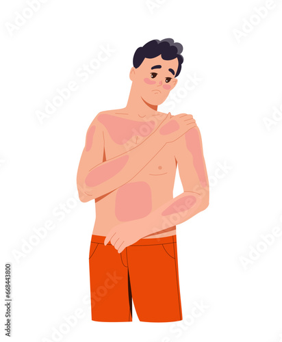 Sun burn person concept. Man with red spots at body. Young guy with skin problems and diseases. Graphic element for website. Cartoon flat vector illustration isolated on white background