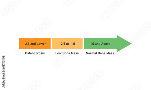 Bone Mass Density (BMD) Levels Concept Design. Vector Illustration.