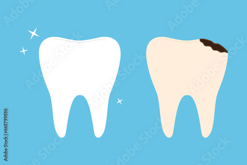 Healthy tooth and caries flat vector illustration