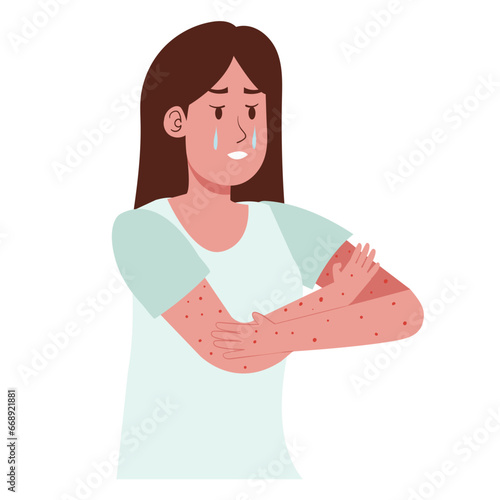 Itching at hand due to Allergy illustration