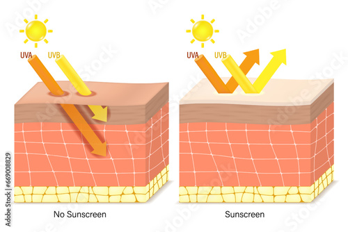 UV Protection. Penetration into the human skin. The difference between skin without sunscreen lotion and skin with sun protection lotion. UVA and UVB radiographs of skin damage.