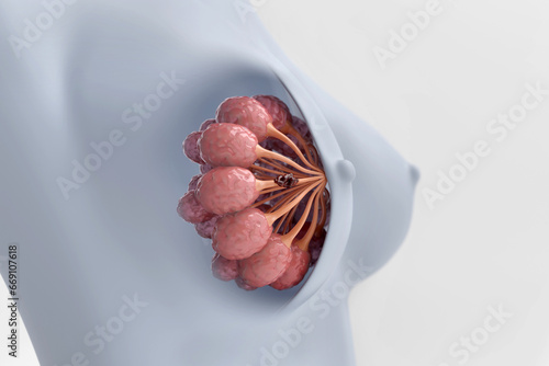 Breast and cancer cell on milk lobes in woman chest, isolated white background, 3D rendering.