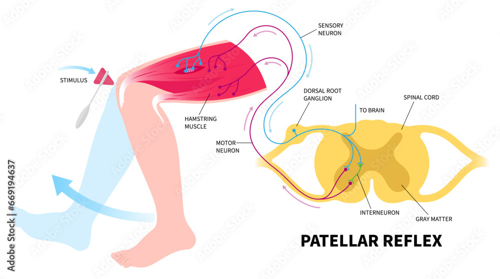Reflex action of leg with motor neuron cell disease in human the neurological control function injury and medical anatomy exam test for muscle weakness stimulation paralysis - obrazy, fototapety, plakaty 