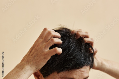 Minimal closeup of senior woman scratching head suffering from anxiety and skin condition, copy space