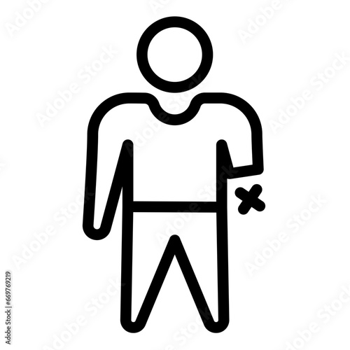 hand amputation