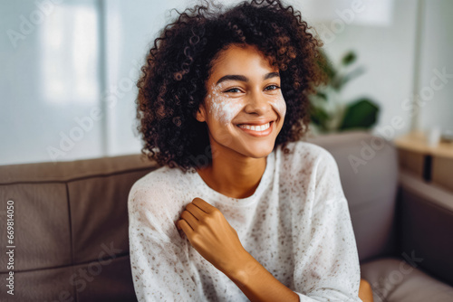 Joyful young african american woman with lost pigment patches on her face smiling and being happy, autoimmune disorder