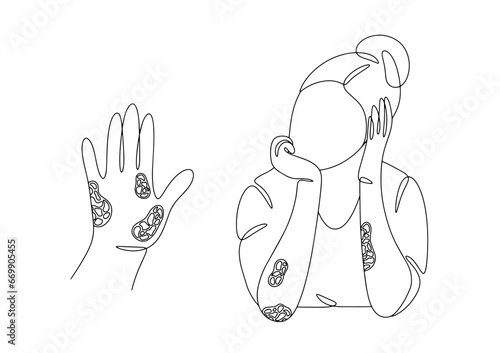 Woman. Psoriasis. One line