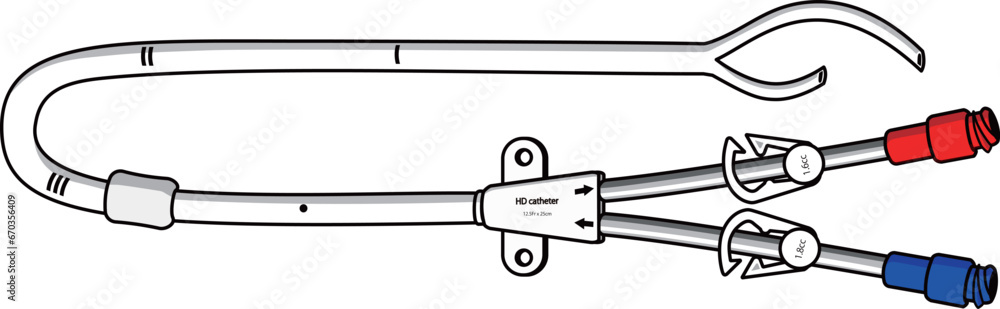 Cuffed catheter with split-tip for hemodialysis Cuffed catheter with split-tip for hemodialysis