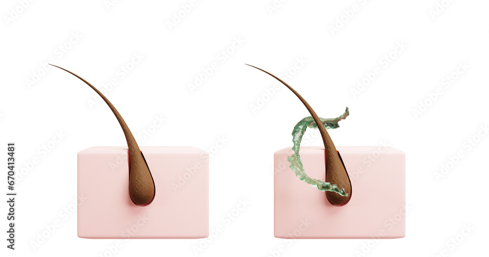 3d illustration of a square piece of skin with hair with gel. Skin care, hair growth, volume creation, impact on the hair bulb, clean skin, nutrition, shampoo, conditioner, serum. 3d illustration of a square piece of skin with hair with gel. Skin care, hair growth, volume creation, impact on the hair bulb, clean skin, nutrition, shampoo, conditioner, serum.