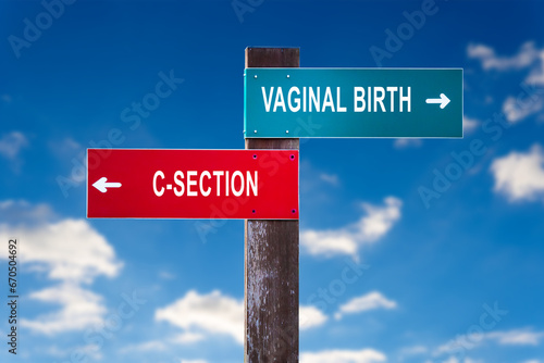 Vaginal Birth versus C-section - Road sign with two options. photo