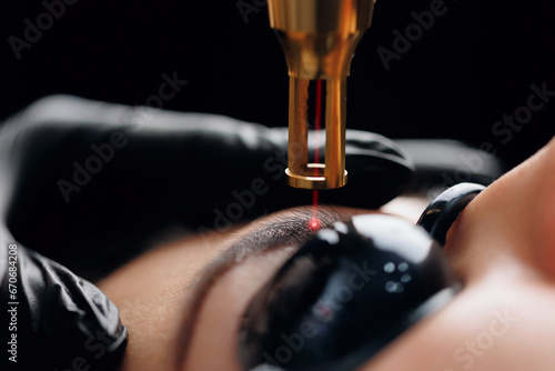Laser removal of tattoo permanent makeup eyebrow of young woman in salon