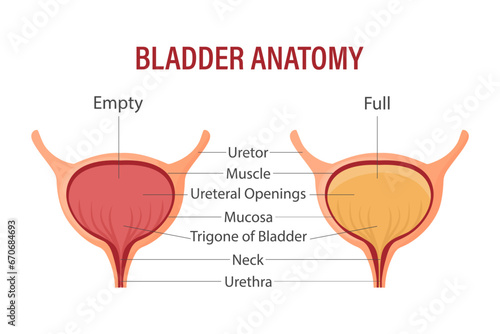Full and empty bladder. Urinary bladder with urine. Anatomy of the human organ. Medicine, healthcare and science. Infographics banner