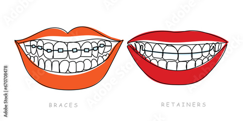 Beautiful smile. Braces and Retainers concept. Poster art. Pop art. Cool and spooky print. Teeth and wide smile. Lively bright and colorful. Glossy lips clip art. Paper cut art. Glamorous. abstract.