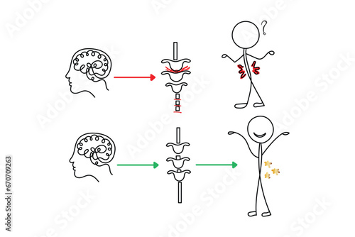 Line art of chiropractic spine adjustments. Spinal injuries and neural connections. Brain and spinal cord physiology and anatomy. Connection. photo