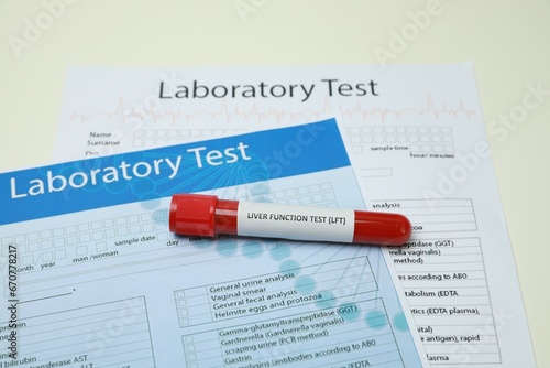 Liver Function Test. Tube with blood sample and forms on white table