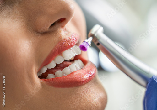Closeup shot of teeth whitening procedure , young woman patient  photo