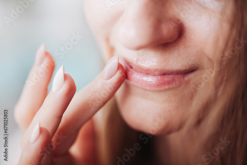 Woman using petrolatum on her mouth. Closeup lips background. Applying lip salve on lips with finger. Beauty background. Young girl skin care. Cosmetics for moisturize. Happy woman smile. photo
