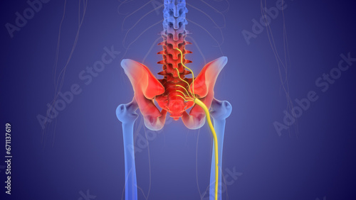 The medical concept of sciatic nerve pain	
