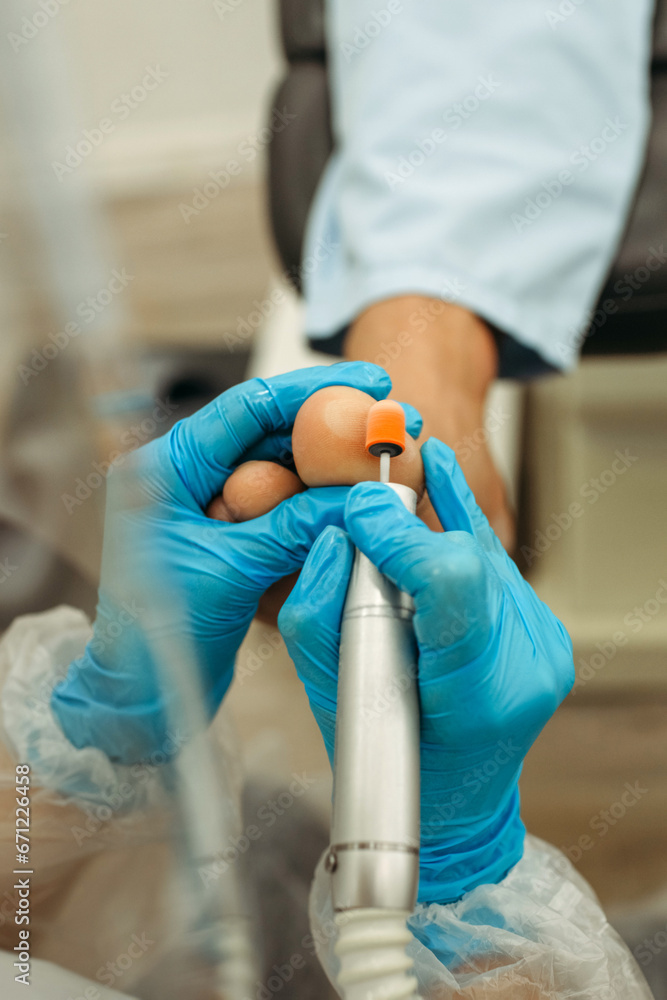 orthopedic doctor in blue gloves doing foot treatment orthopedic doctor in blue gloves doing foot treatment