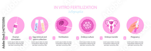 IVF infographic concept. Fertilization and ovulation. Reproductive system and health care. Gynecology, anatomy and biology. Cartoon flat vector illustration isolated on white background photo