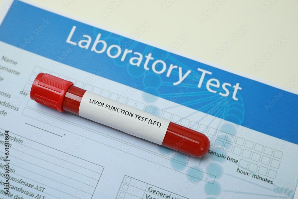 Liver Function Test. Tube with blood sample and form on white table