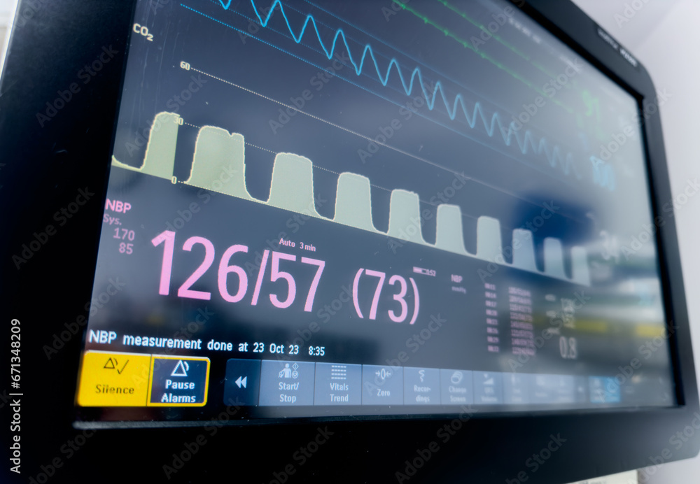 hospital monitor displaying vital signs blood pressure, heart rate