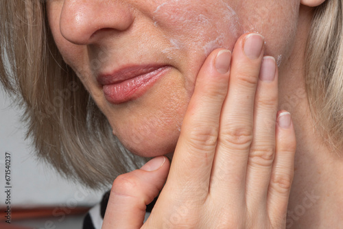 Care for problem skin of an adult woman. Applying cream for perfect results