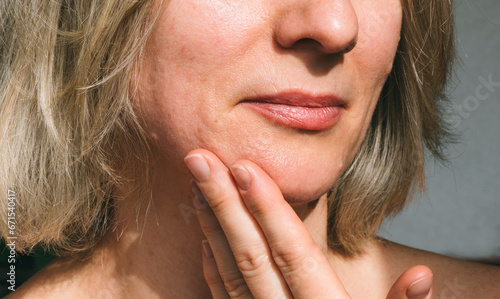 Woman's face with macro photo,  of large pores on combination skin. Care and cosmetics