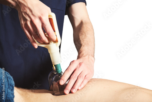 Close-up of doctor hands puts medical vacuum cups on patient back. Medic vacuum cup, health rehabilitation, cupping therapy on human body. Wellness, alternative medicine concept. Copy ad text space