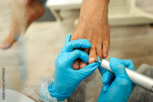 orthopedic doctor in blue gloves doing foot treatment
