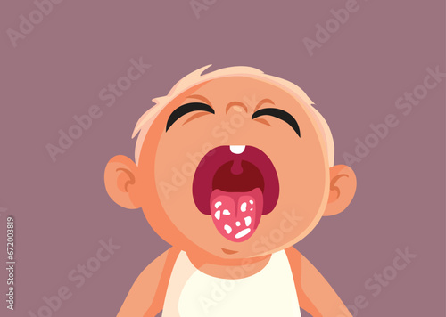 Little Baby Suffers from Candidiasis Vector Cartoon Illustration. Unhappy infant suffering from milk tongue or oral tush 
