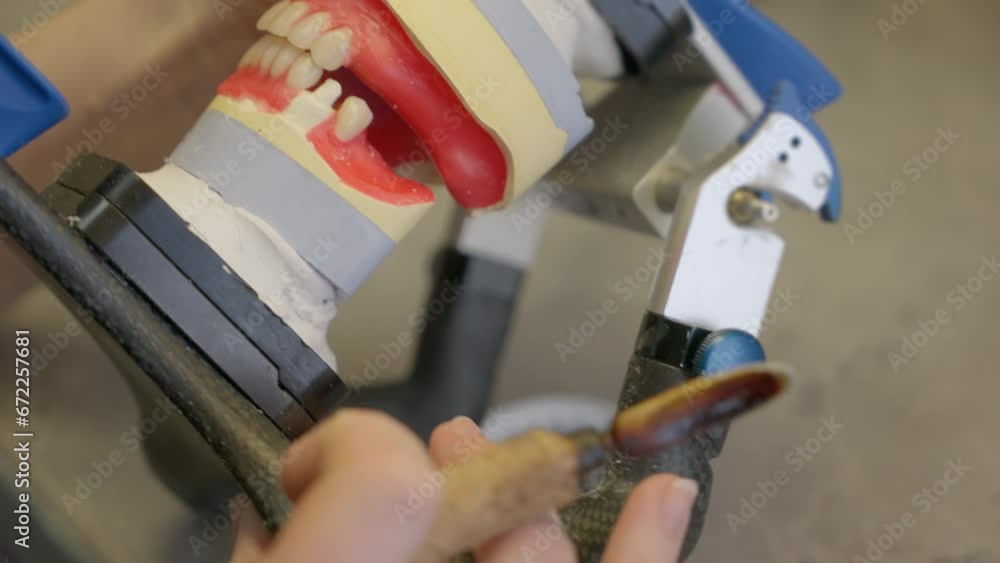 Stockvideo Applying dental adhesive to the teeth on the artificial jaw