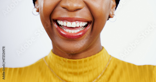Teeth whitening, smile and closeup of black woman and mouth, lips or happiness in studio white background. Dental, healthcare or happy with veneers from orthodontics and half of face at dentist photo