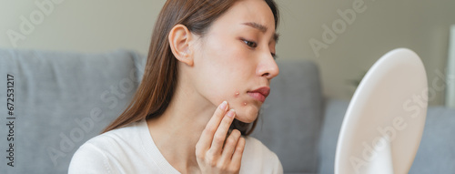 Asian young woman worry about acne on her face after wear face mask. photo