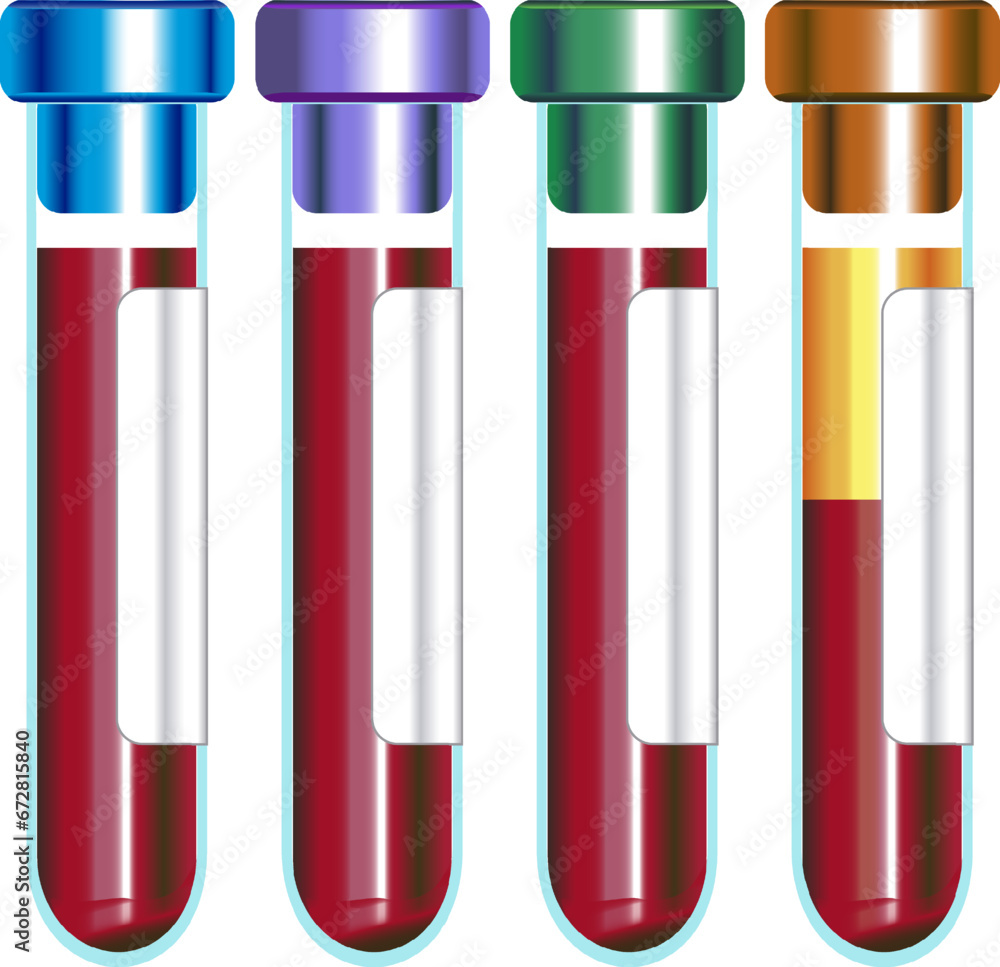 Blood collection tube with cap color indicating it contains heparin