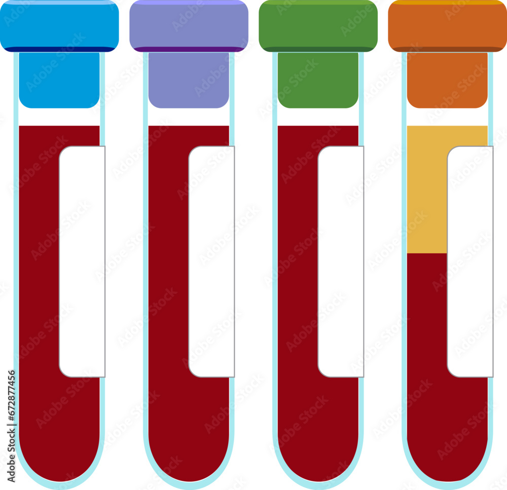 Blood collection tube with cap color indicating it contains heparin EDTA citrate or no anticoagulant Blood collection tube with cap color indicating it contains heparin EDTA citrate or no anticoagulant