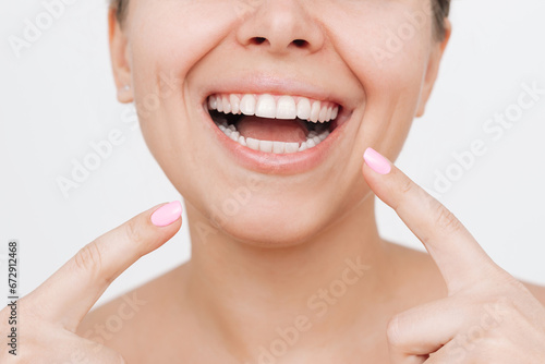 Young caucasian woman pointing at a beautiful smile with her fingers isolated on a white background. Teeth whitening. Oral hygiene, dental health care, perfect even teeth. Dentistry concept. Veneers