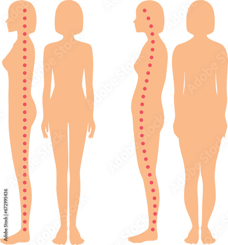 良い姿勢と悪い姿勢の女性の全身シルエット