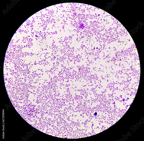 Quadro em tela Bacterial colonies gram stained microscopic show Staphylococcus aureus  Bacteria