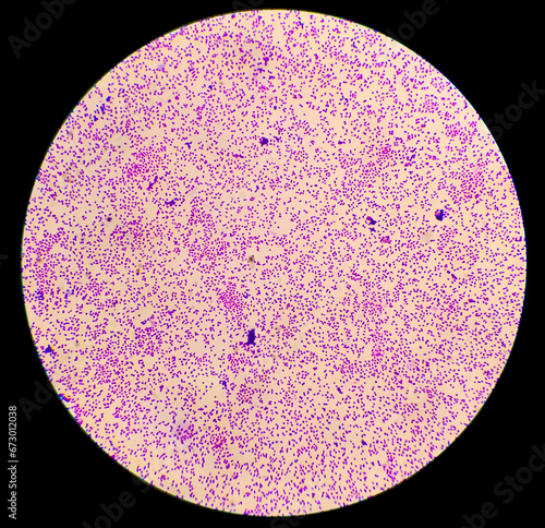 Billede på lærred Bacteria colonies gram stained microscopic show Escherichia coli (E