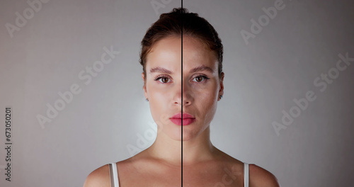 Woman Before And After Face Lift Therapy photo